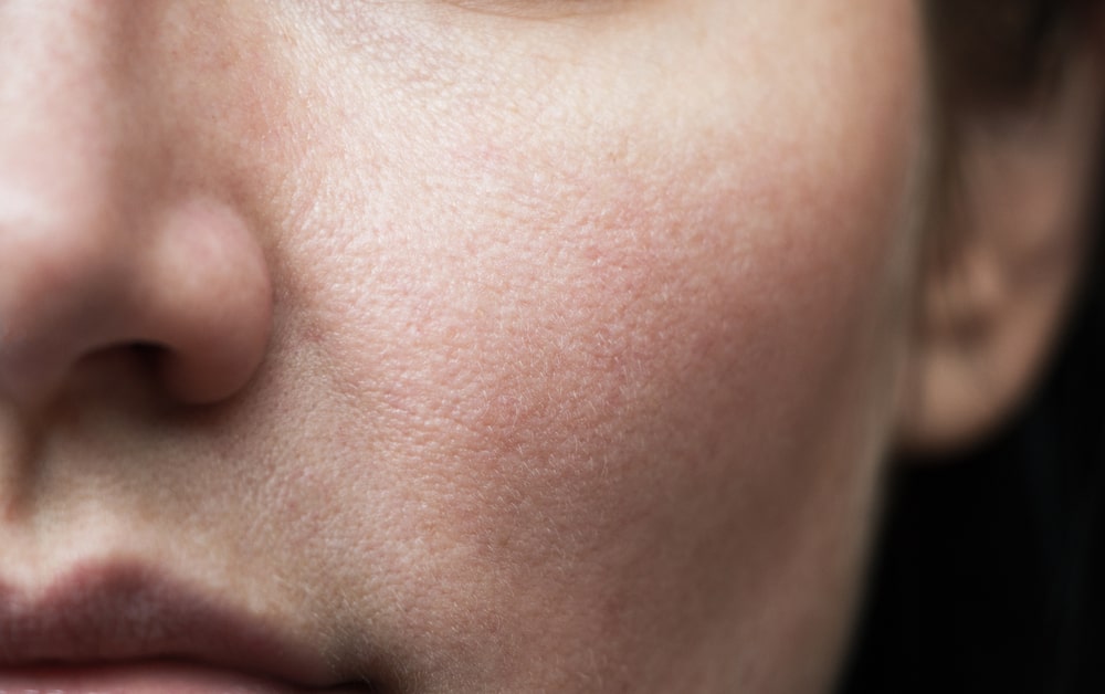 فیشال پوست صورت برای انواع پوست 3 Blog 2 Sensitve Skin