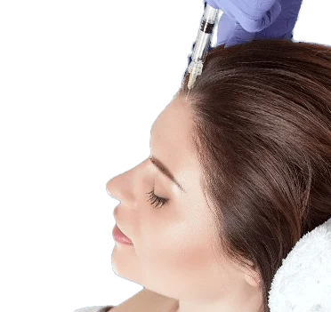 هیر فیلر چیست و چه کاربردی دارد؟ 4 HAIR RESTORATION 2 e1734004408932