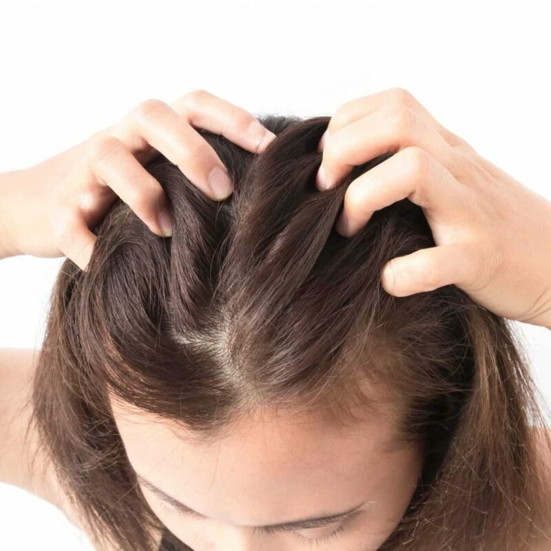 اسکراب اسکالپ و انواع آن 2 اسکراب اسکالپ وانواع آن
